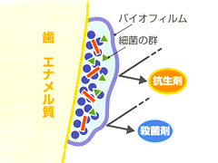 歯の汚れは虫歯や歯周病の原因になります