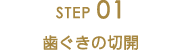 STEP01歯ぐきの切開